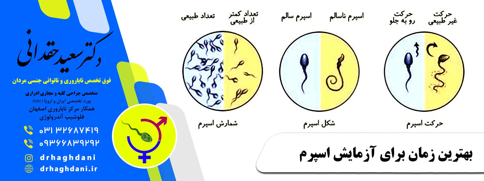 از کجا بفهمیم اسپرم سالمی داریم؟